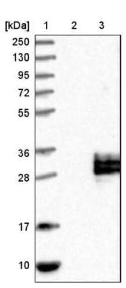 C12orf49 Antibody, Novus Biologicals 25 &mu;L | Buy Online | Novus Biologicals | Fisher Scientific