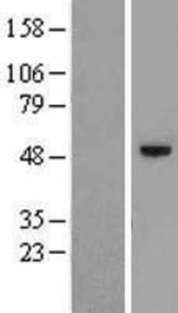 Novus Biologicals™ C12orf50 Overexpression Lysate