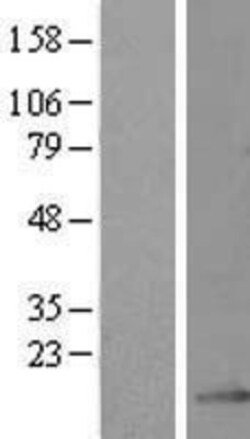 Novus Biologicals&trade;&nbsp;GRCC10 Overexpression Lysate