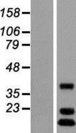 Novus Biologicals&trade;&nbsp;C12orf65 Overexpression Lysate