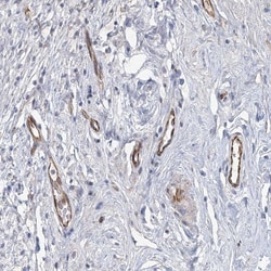 C12orf65 Antibody, Novus Biologicals:Antibodies:Primary Antibodies