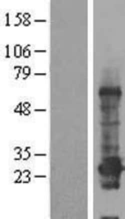 Novus Biologicals&trade;&nbsp;CCDC184 Overexpression Lysate