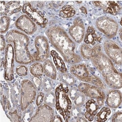 SMCO3 Antibody, Novus Biologicals 25 &mu;L, Unlabeled:Antibodies, Polyclonal