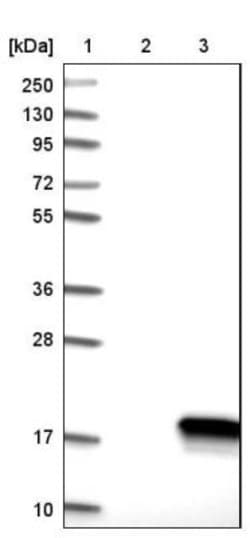 C14orf119 Antibody, Novus Biologicals 0.1mL; Unlabeled:Antibodies, Polyclonal