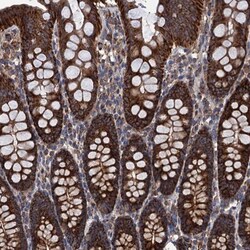 DGLUCY Antibody, Novus Biologicals 25 &mu;L; Unlabeled:Antibodies, Polyclonal