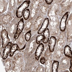 ADAM2 Antibody, Novus Biologicals:Antibodies:Primary Antibodies