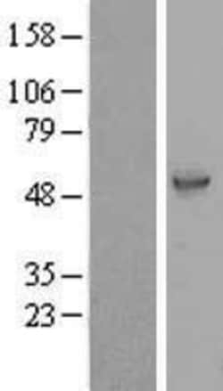 Novus Biologicals&trade;&nbsp;LRRC74A Overexpression Lysate