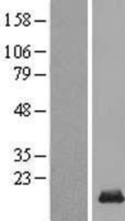 Novus Biologicals&trade;&nbsp;C14orf177 Overexpression Lysate