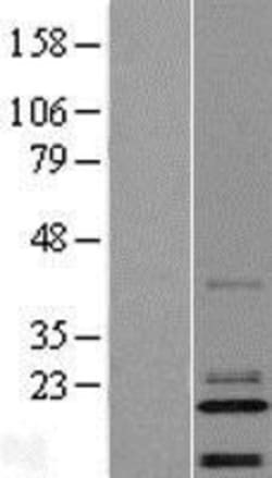 Novus Biologicals™ C14orf180 Overexpression Lysate