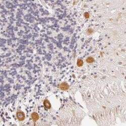 Chondroitin sulfate synthase 3 Antibody, Novus Biologicals:Antibodies:Primary