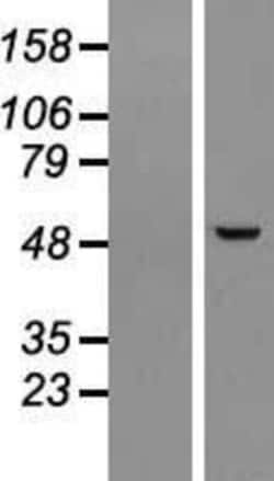 Novus Biologicals&trade;&nbsp;PPP1R36 Overexpression Lysate