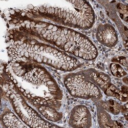 TEDC1 Antibody, Novus Biologicals:Antibodies:Primary Antibodies