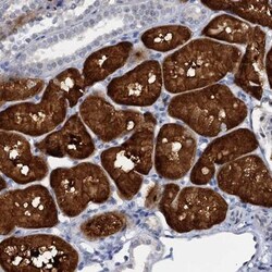 C15orf39 Antibody, Novus Biologicals 0.1mL; Unlabeled:Antibodies, Polyclonal