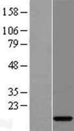 Novus Biologicals&trade;&nbsp;C15orf40 Overexpression Lysate