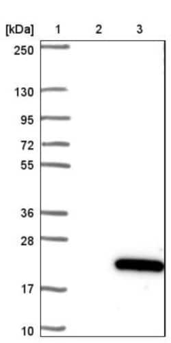 C15orf40 Antibody, Novus Biologicals 25 &mu;L; Unlabeled:Antibodies, Polyclonal