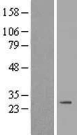 Novus Biologicals™ TERB2 Overexpression Lysate