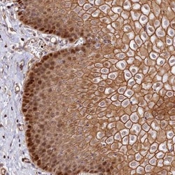 LINC02694 Antibody, Novus Biologicals 0.1mL; Unlabeled:Antibodies, Polyclonal