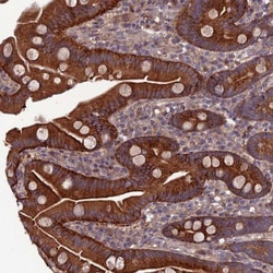 C15orf62 Antibody, Novus Biologicals 0.1mL; Unlabeled:Antibodies, Polyclonal