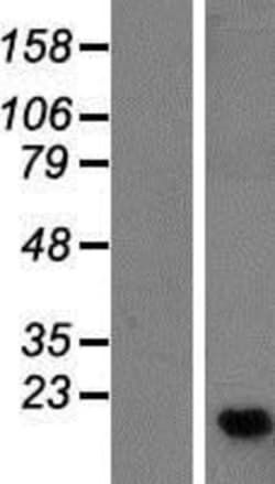 Novus Biologicals™ METTL26 Overexpression Lysate
