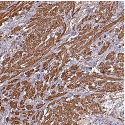 CCDC154 Antibody, Novus Biologicals 0.1mL; Unlabeled:Antibodies, Polyclonal