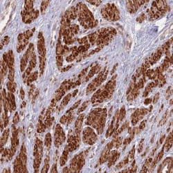 CCDC154 Antibody, Novus Biologicals 25 &mu;L, Unlabeled:Antibodies, Polyclonal