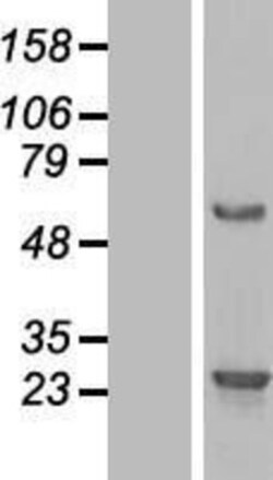 Novus Biologicals™ BMERB1 Overexpression Lysate