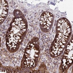 C16orf54 Antibody, Novus Biologicals:Antibodies:Primary Antibodies