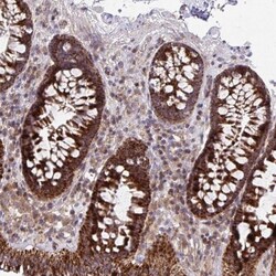 C16orf54 Antibody, Novus Biologicals:Antibodies:Primary Antibodies