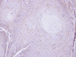VPS35L Antibody, Novus Biologicals 0.1mg; Unlabeled:Antibodies, Polyclonal