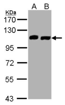 VPS35L Antibody, Novus Biologicals 0.1mg; Unlabeled:Antibodies, Polyclonal