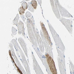 VPS9D1 Antibody, Novus Biologicals:Antibodies:Primary Antibodies