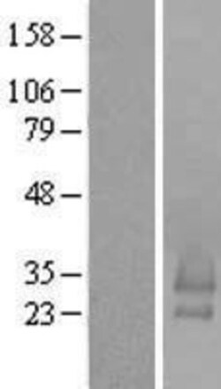 Novus Biologicals™ BRICD5 Overexpression Lysate