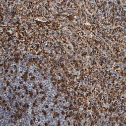 VPS9D1 Antibody, Novus Biologicals 25 &mu;L; Unlabeled:Antibodies, Polyclonal