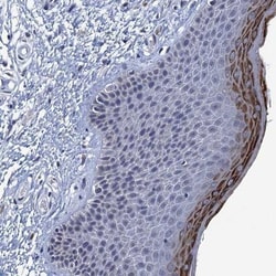 APEH Antibody, Novus Biologicals:Antibodies:Primary Antibodies
