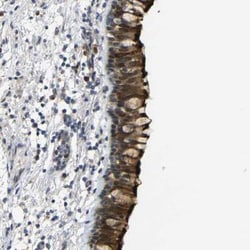 C16orf89 Antibody, Novus Biologicals:Antibodies:Primary Antibodies