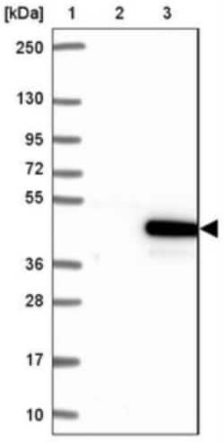 CCDC189 Antibody, Novus Biologicals 0.1mL; Unlabeled:Antibodies, Polyclonal
