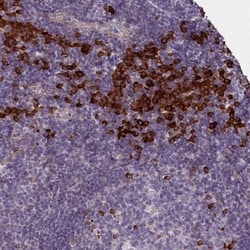 C16orf96 Antibody, Novus Biologicals 25 &mu;L; Unlabeled:Antibodies, Polyclonal