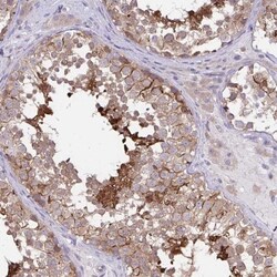 CFAP97D1 Antibody, Novus Biologicals 0.1mL; Unlabeled:Antibodies, Polyclonal
