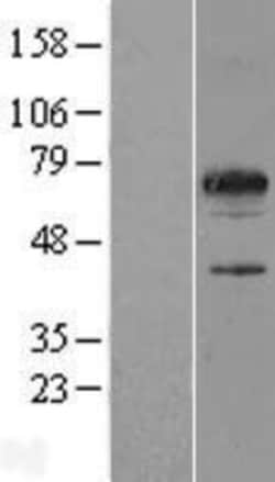 Novus Biologicals&trade;&nbsp;SPATA32 Overexpression Lysate