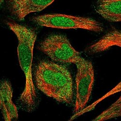 C17orf47 Antibody, Novus Biologicals 25 &mu;L | Buy Online | Novus Biologicals | Fisher Scientific