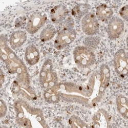 C17orf47 Antibody, Novus Biologicals 25 &mu;L | Buy Online | Novus Biologicals | Fisher Scientific