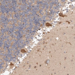 HROB Antibody, Novus Biologicals 25 &mu;L, Unlabeled:Antibodies, Polyclonal