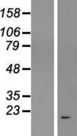 Novus Biologicals&trade;&nbsp;C17orf58 Overexpression Lysate