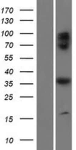 Novus Biologicals&trade;&nbsp;BORC6 Overexpression Lysate