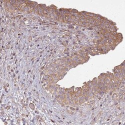 CYBC1 Antibody, Novus Biologicals 0.1mL; Unlabeled:Antibodies, Polyclonal