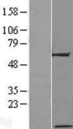 Novus Biologicals™ C17orf64 Overexpression Lysate