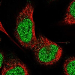 PKN1 Antibody, Novus Biologicals:Antibodies:Primary Antibodies