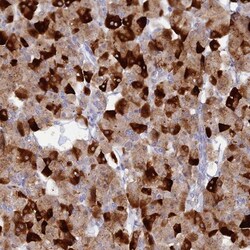 PKN1 Antibody, Novus Biologicals:Antibodies:Primary Antibodies