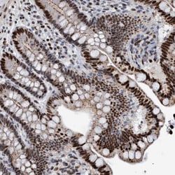 HEATR9 Antibody, Novus Biologicals 0.1mL; Unlabeled:Antibodies, Polyclonal