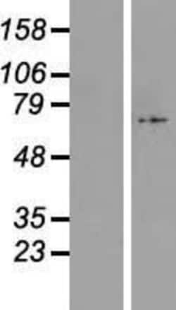 Novus Biologicals&trade;&nbsp;C17orf80 Overexpression Lysate